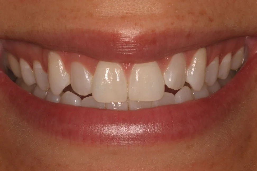 Patient 1 before treatment