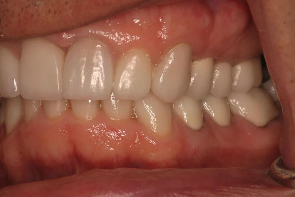 Patient 3 after treatment